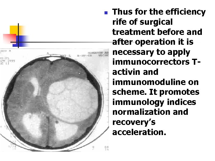 n Thus for the efficiency rife of surgical treatment before and after operation it