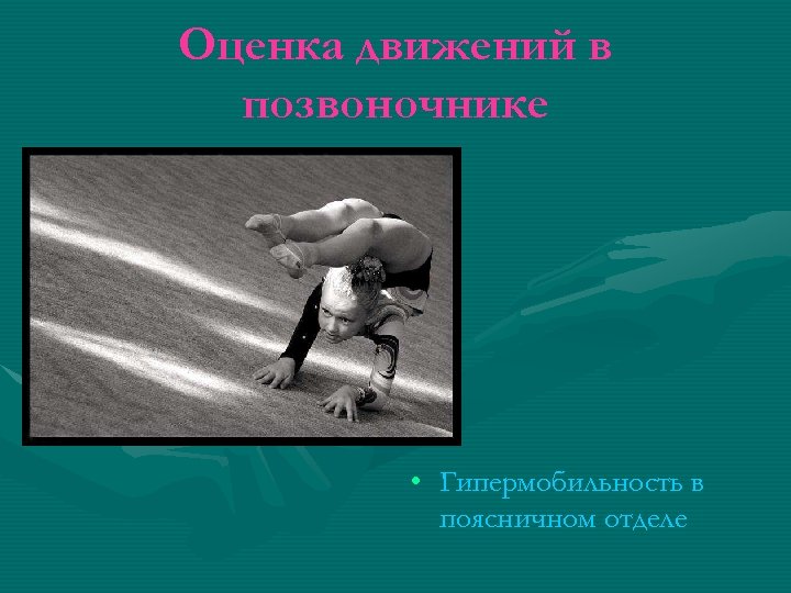 Оценка движений в позвоночнике • Гипермобильность в поясничном отделе 