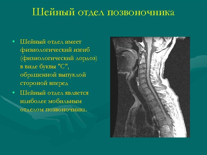 Шейный отдел позвоночника • Шейный отдел имеет физиологический изгиб (физиологический лордоз) в виде буквы