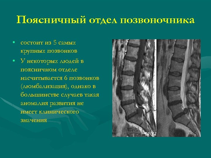 Поясничный отдел позвоночника • состоит из 5 самых крупных позвонков • У некоторых людей