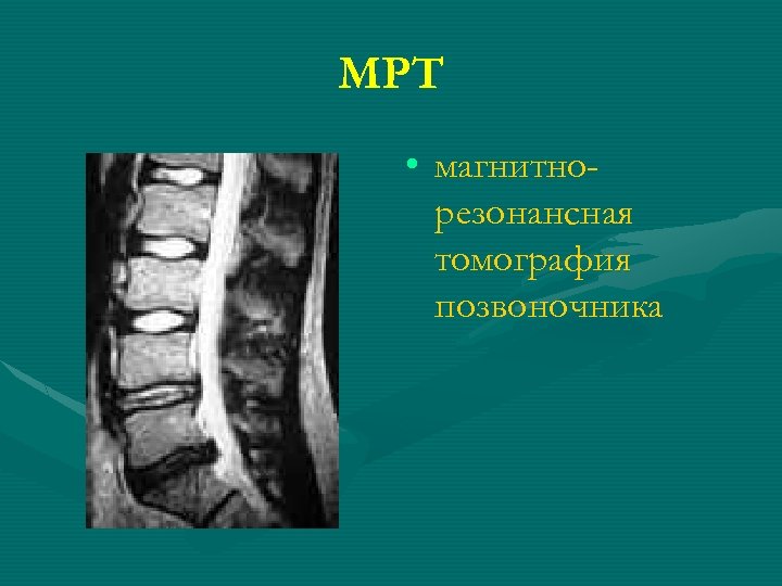 МРТ • магнитнорезонансная томография позвоночника 