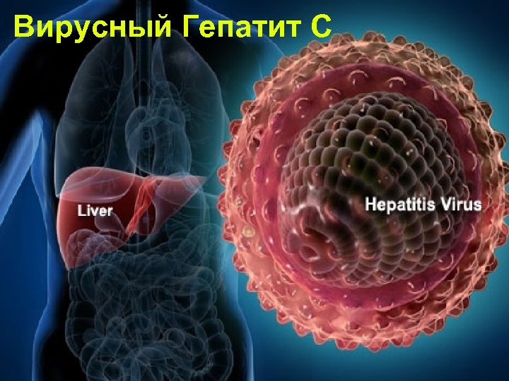 Вирусный Гепатит С 