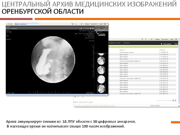 ЦЕНТРАЛЬНЫЙ АРХИВ МЕДИЦИНСКИХ ИЗОБРАЖЕНИЙ ОРЕНБУРГСКОЙ ОБЛАСТИ Архив аккумулирует снимки из 18 ЛПУ области с