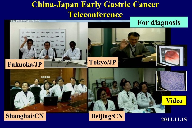 China-Japan Early Gastric Cancer Teleconference For diagnosis Fukuoka/JP Tokyo/JP Video Shanghai/CN Beijing/CN 2011. 15