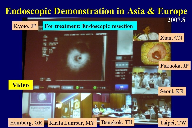Endoscopic Demonstration in Asia & Europe Kyoto, JP For treatment: Endoscopic resection 2007. 8