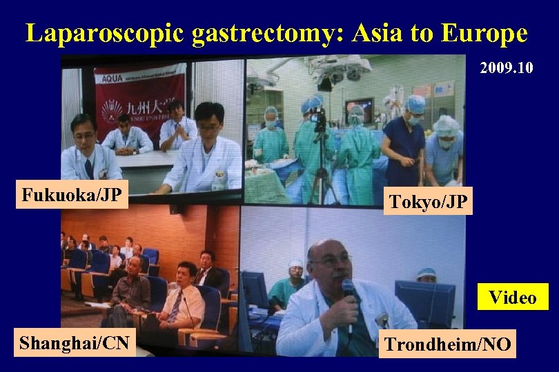 Laparoscopic gastrectomy: Asia to Europe 2009. 10 Fukuoka/JP Tokyo/JP Video Shanghai/CN Trondheim/NO 