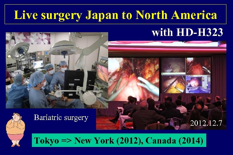Live surgery Japan to North America with HD-H 323 Bariatric surgery 2012. 7 Tokyo