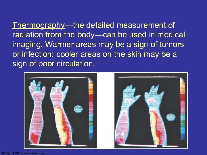 Thermography—the detailed measurement of radiation from the body—can be used in medical imaging. Warmer