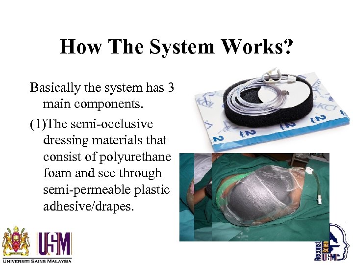 How The System Works? Basically the system has 3 main components. (1)The semi-occlusive dressing