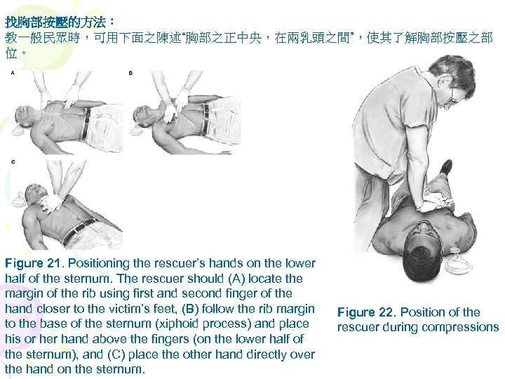 找胸部按壓的方法： 教一般民眾時，可用下面之陳述“胸部之正中央，在兩乳頭之間”，使其了解胸部按壓之部 位。 Figure 21. Positioning the rescuer’s hands on the lower half of