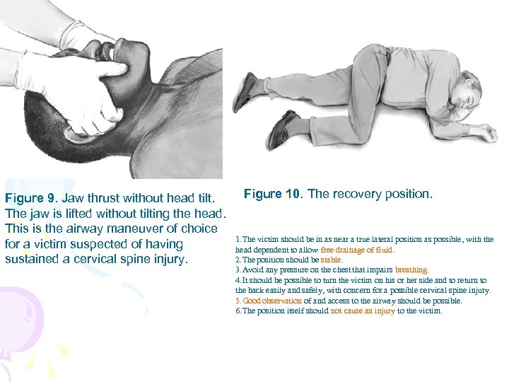 Figure 9. Jaw thrust without head tilt. The jaw is lifted without tilting the