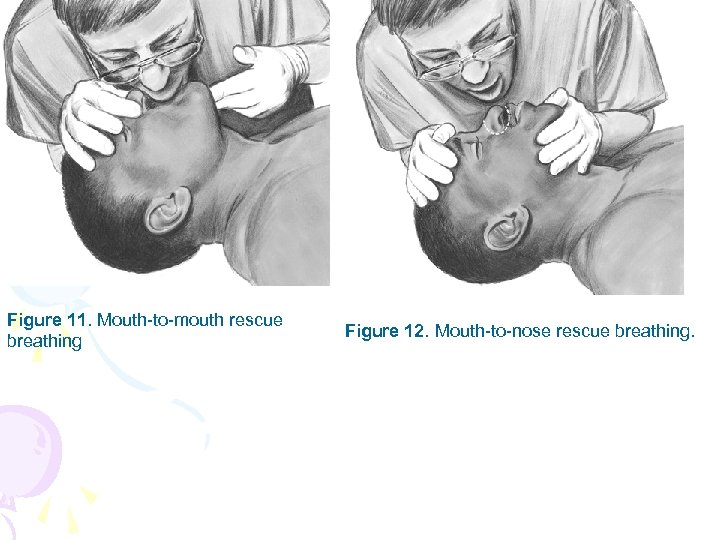 Figure 11. Mouth-to-mouth rescue breathing Figure 12. Mouth-to-nose rescue breathing. 