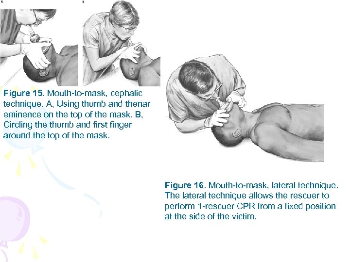 Figure 15. Mouth-to-mask, cephalic technique. A, Using thumb and thenar eminence on the top