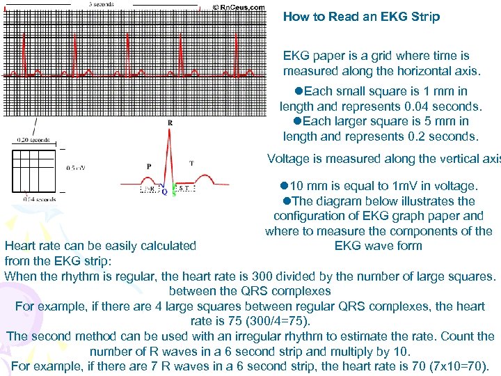 How to Read an EKG Strip EKG paper is a grid where time is