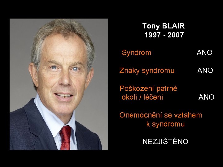  Tony BLAIR 1997 - 2007 Syndrom ANO Znaky syndromu ANO Poškození patrné okolí