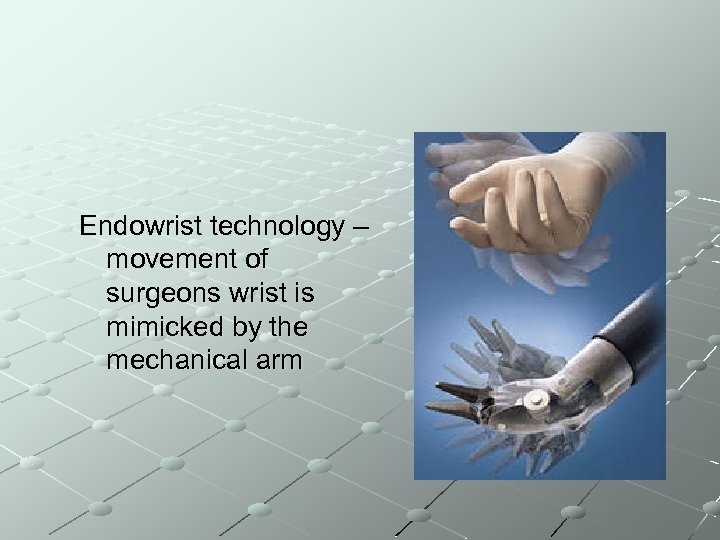 Endowrist technology – movement of surgeons wrist is mimicked by the mechanical arm 