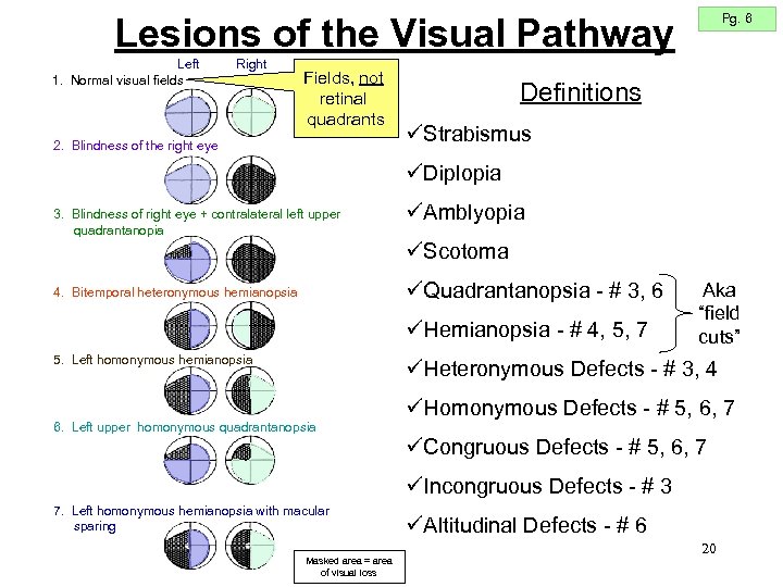 Pg. 6 Lesions of the Visual Pathway Left 1. Normal visual fields Right Fields,