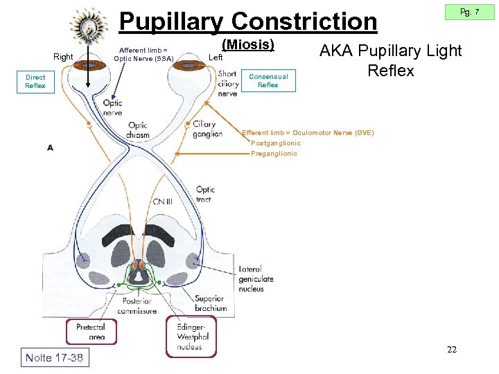 Pg. 7 Pupillary Constriction Right Direct Reflex Afferent limb = Optic Nerve (SSA) (Miosis)