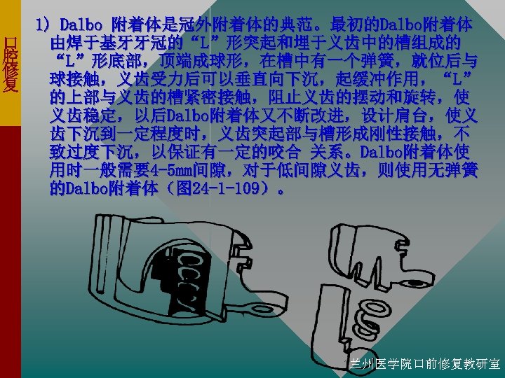 口 腔 修 复 1) Dalbo 附着体是冠外附着体的典范。最初的Dalbo附着体 由焊于基牙牙冠的“L”形突起和埋于义齿中的槽组成的 “L”形底部，顶端成球形，在槽中有一个弹簧，就位后与 球接触，义齿受力后可以垂直向下沉，起缓冲作用，“L” 的上部与义齿的槽紧密接触，阻止义齿的摆动和旋转，使 义齿稳定，以后Dalbo附着体又不断改进，设计肩台，使义 齿下沉到一定程度时，义齿突起部与槽形成刚性接触，不 致过度下沉，以保证有一定的咬合