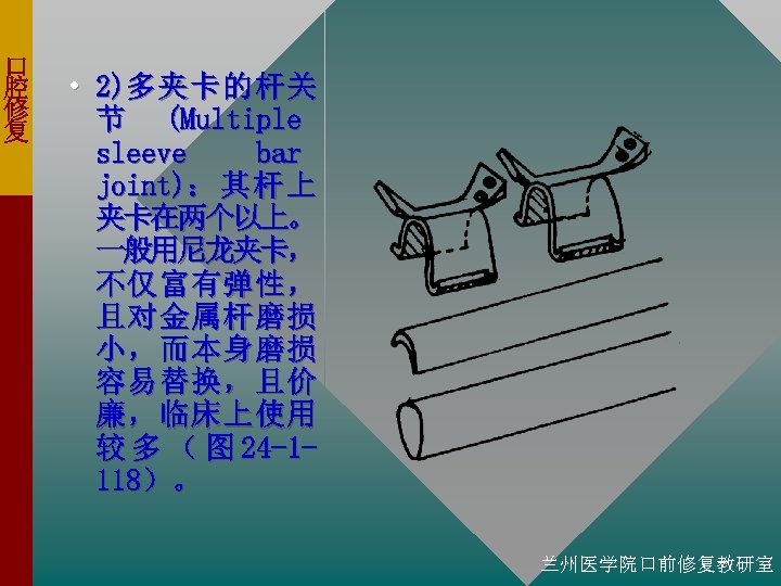 口 腔 修 复 • 2)多 夹 卡 的 杆 关 节 (Multiple sleeve