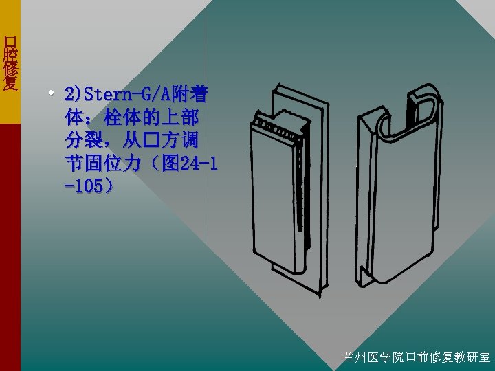 口 腔 修 复 • 2)Stern-G/A附着 体：栓体的上部 分裂，从 方调 节固位力（图 24 -1 -105） 兰州医学院口前修复教研室