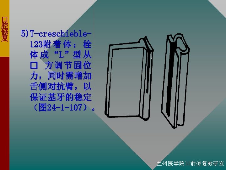 口 腔 修 复 5)T-creschieble 123附 着 体 ： 栓 体 成 “L”型 从