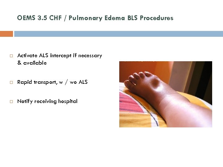 OEMS 3. 5 CHF / Pulmonary Edema BLS Procedures Activate ALS intercept if necessary