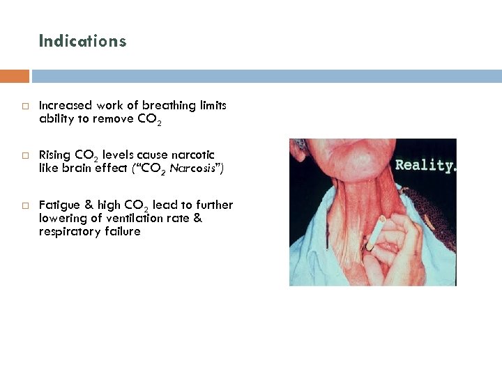 Indications Increased work of breathing limits ability to remove CO 2 Rising CO 2