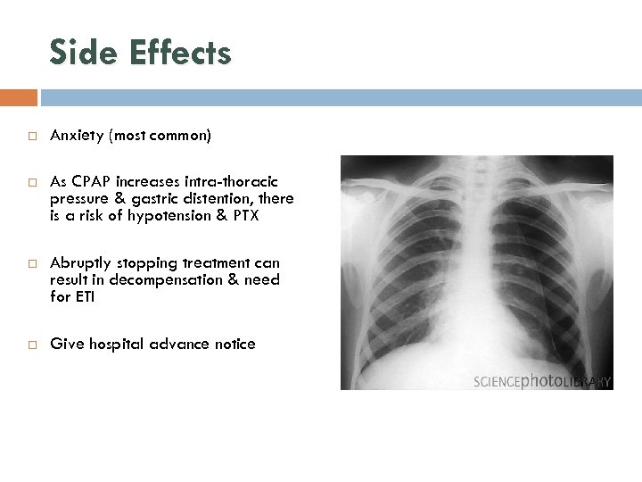 Side Effects Anxiety (most common) As CPAP increases intra-thoracic pressure & gastric distention, there