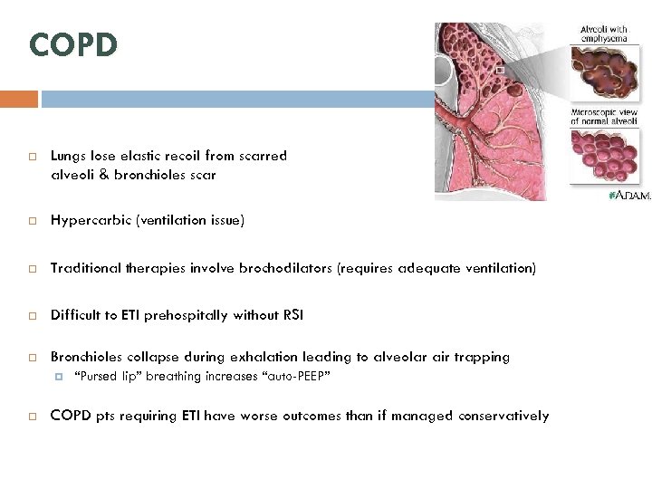 COPD Lungs lose elastic recoil from scarred alveoli & bronchioles scar Hypercarbic (ventilation issue)