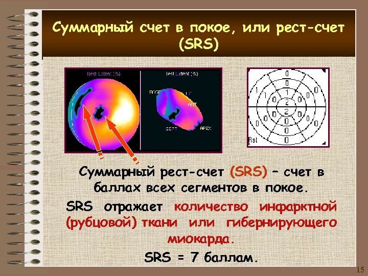 Суммарный счет в покое, или рест-счет (SRS) Суммарный рест-счет (SRS) – счет в баллах