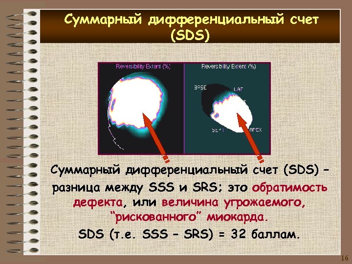 Суммарный дифференциальный счет (SDS) – разница между SSS и SRS; это обратимость дефекта, или