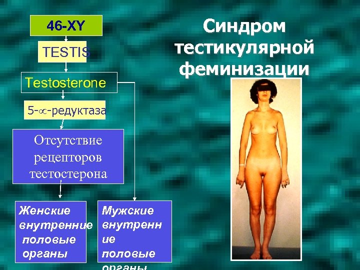 46 -XY TESTIS Testosterone 5 - -редуктаза Отсутствие рецепторов тестостерона Женские внутренние половые органы