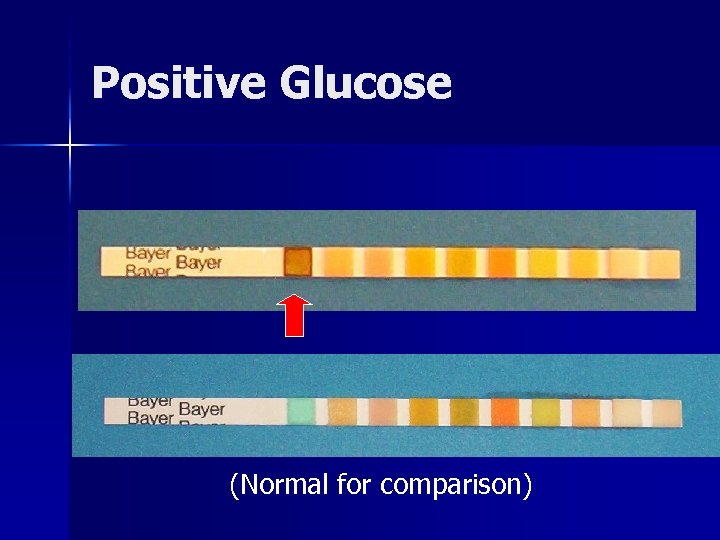 Positive Glucose (Normal for comparison) 