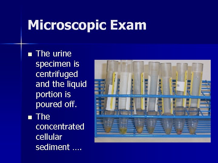 Microscopic Exam n n The urine specimen is centrifuged and the liquid portion is