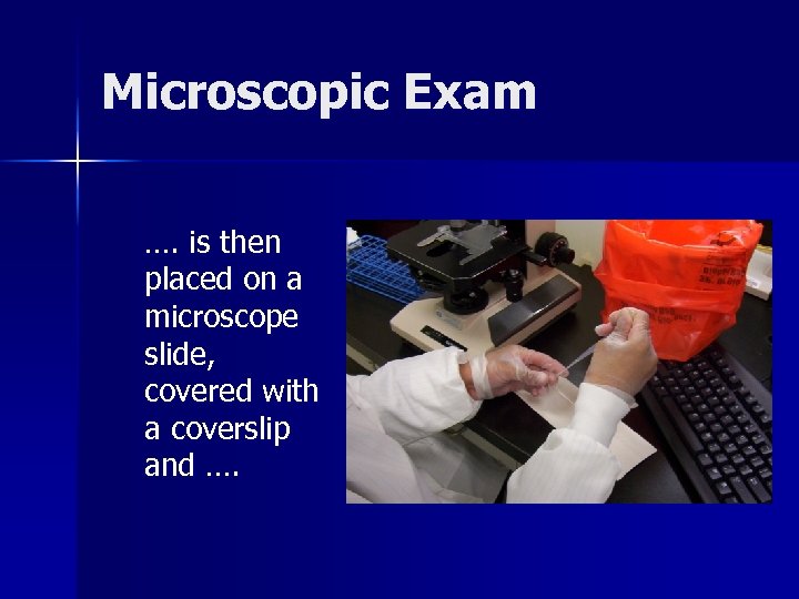 Microscopic Exam …. is then placed on a microscope slide, covered with a coverslip