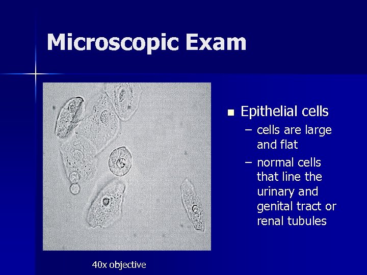 Microscopic Exam n Epithelial cells – cells are large and flat – normal cells