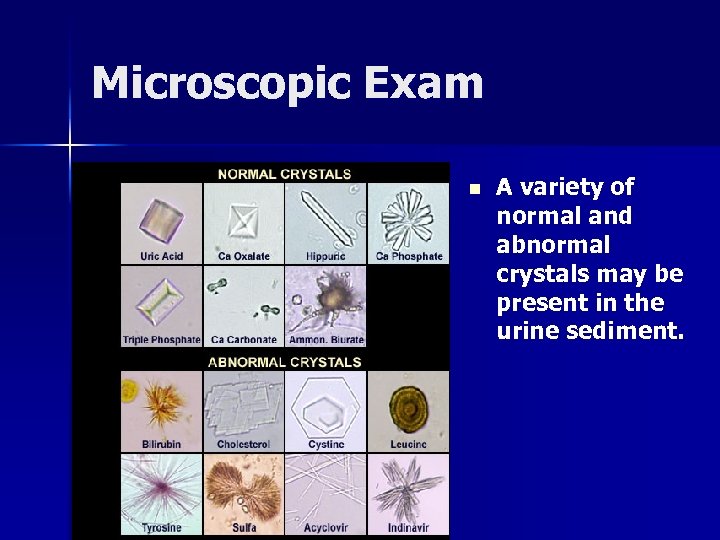 Microscopic Exam n A variety of normal and abnormal crystals may be present in