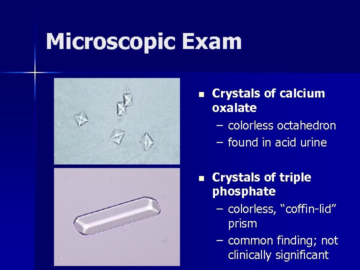Microscopic Exam n Crystals of calcium oxalate – colorless octahedron – found in acid