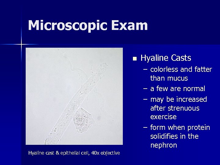 Microscopic Exam n Hyaline Casts – colorless and fatter than mucus – a few