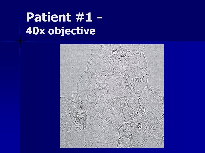 Patient #1 40 x objective 