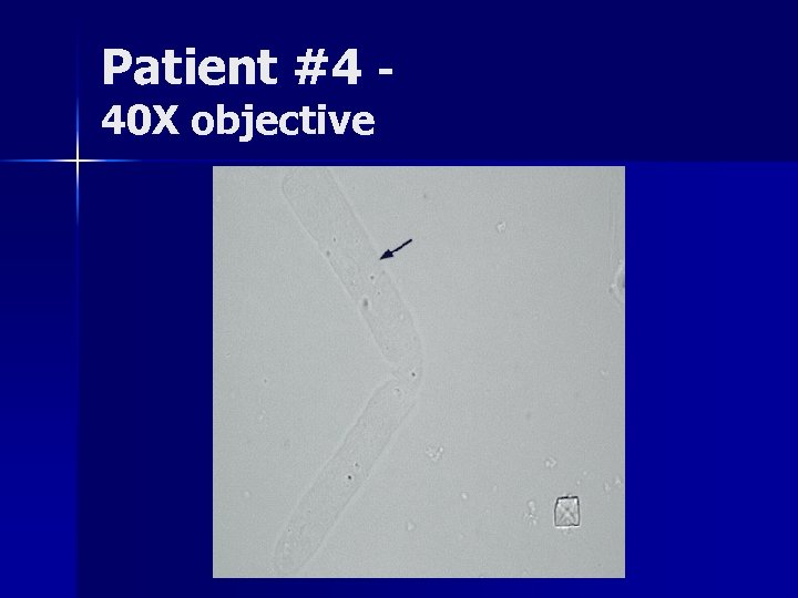 Patient #4 40 X objective 
