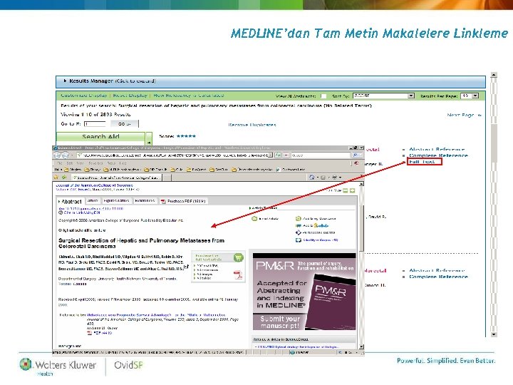 MEDLINE’dan Tam Metin Makalelere Linkleme 