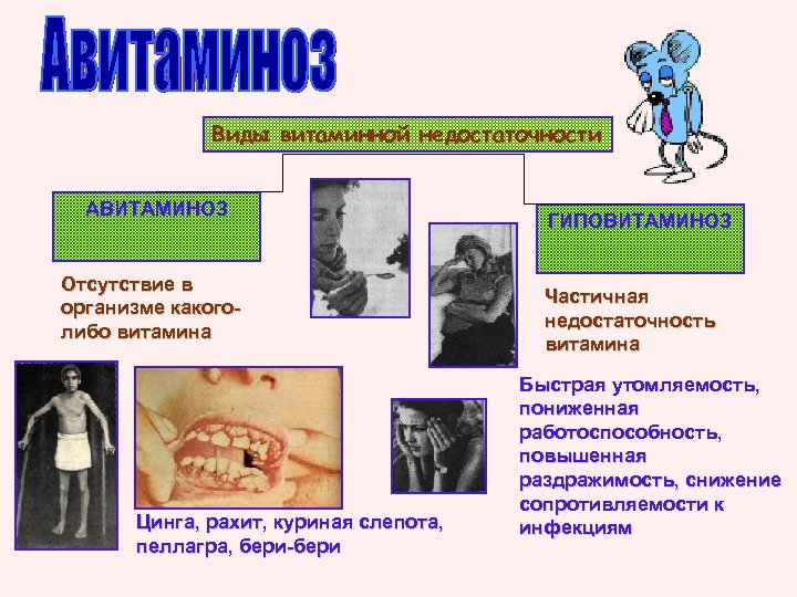 Виды витаминной недостаточности АВИТАМИНОЗ Отсутствие в организме какоголибо витамина Цинга, рахит, куриная слепота, пеллагра,