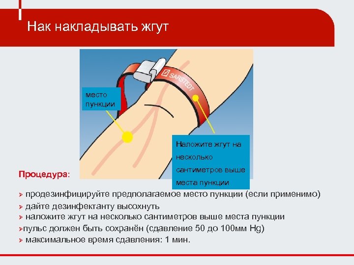 Место наложения артериального жгута