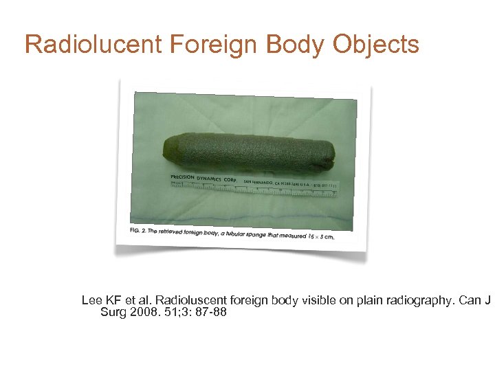 Radiolucent Foreign Body Objects Lee KF et al. Radioluscent foreign body visible on plain