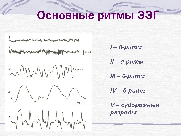 Основные ритмы ЭЭГ I – β-ритм II – α-ритм III – θ-ритм IV –