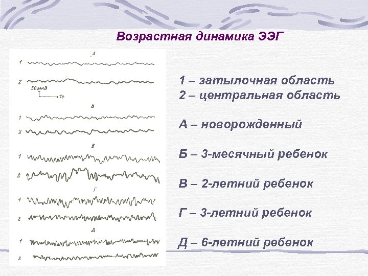 Возрастная динамика ЭЭГ 1 – затылочная область 2 – центральная область А – новорожденный