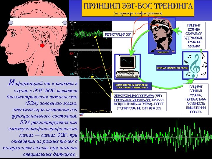 Информацией от пациента в случае с ЭЭГ-БОС является биоэлектрическая активность (БЭА) головного мозга, отражающая