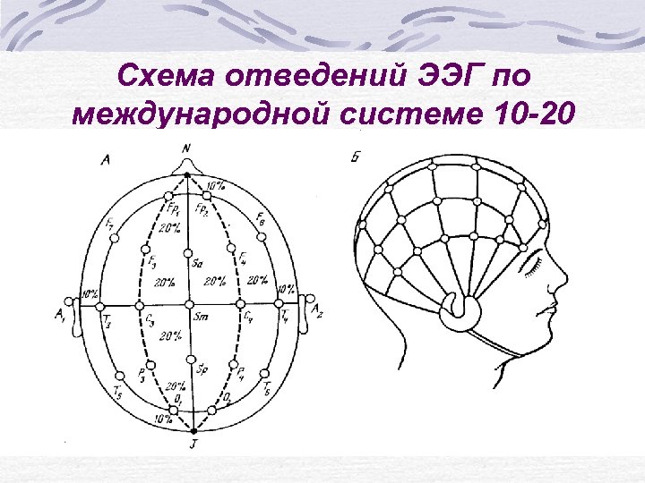 Схема 10 20 наложение электродов